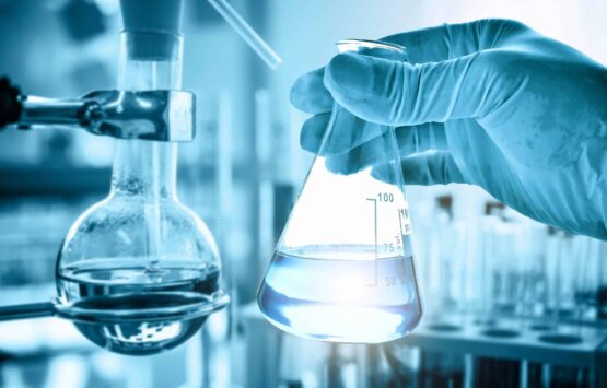 hand of scientist holding flask with lab glassware in chemical laboratory background, science laboratory research and development concept